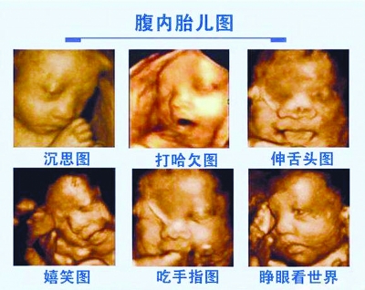 南京四维彩超流行 医院宣称能看清胎儿潜在缺