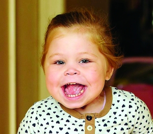 英两岁女童舌头长不停 是正常尺寸3倍无法控制
