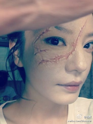 赵薇晒"皮开肉绽"刀疤脸 网友被吓呼"重口味"_新闻台_中国网络电视台
