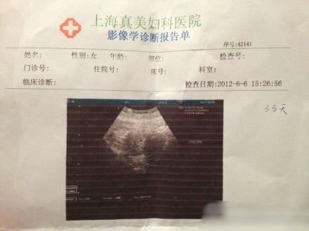 袁莉被曝怀孕1个月 外籍老公兴奋晒婴儿b超照(图)