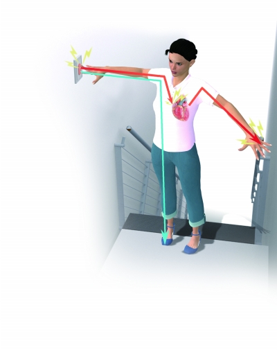 女子按楼道灯开关触电昏迷 心脏被电流击穿(图)